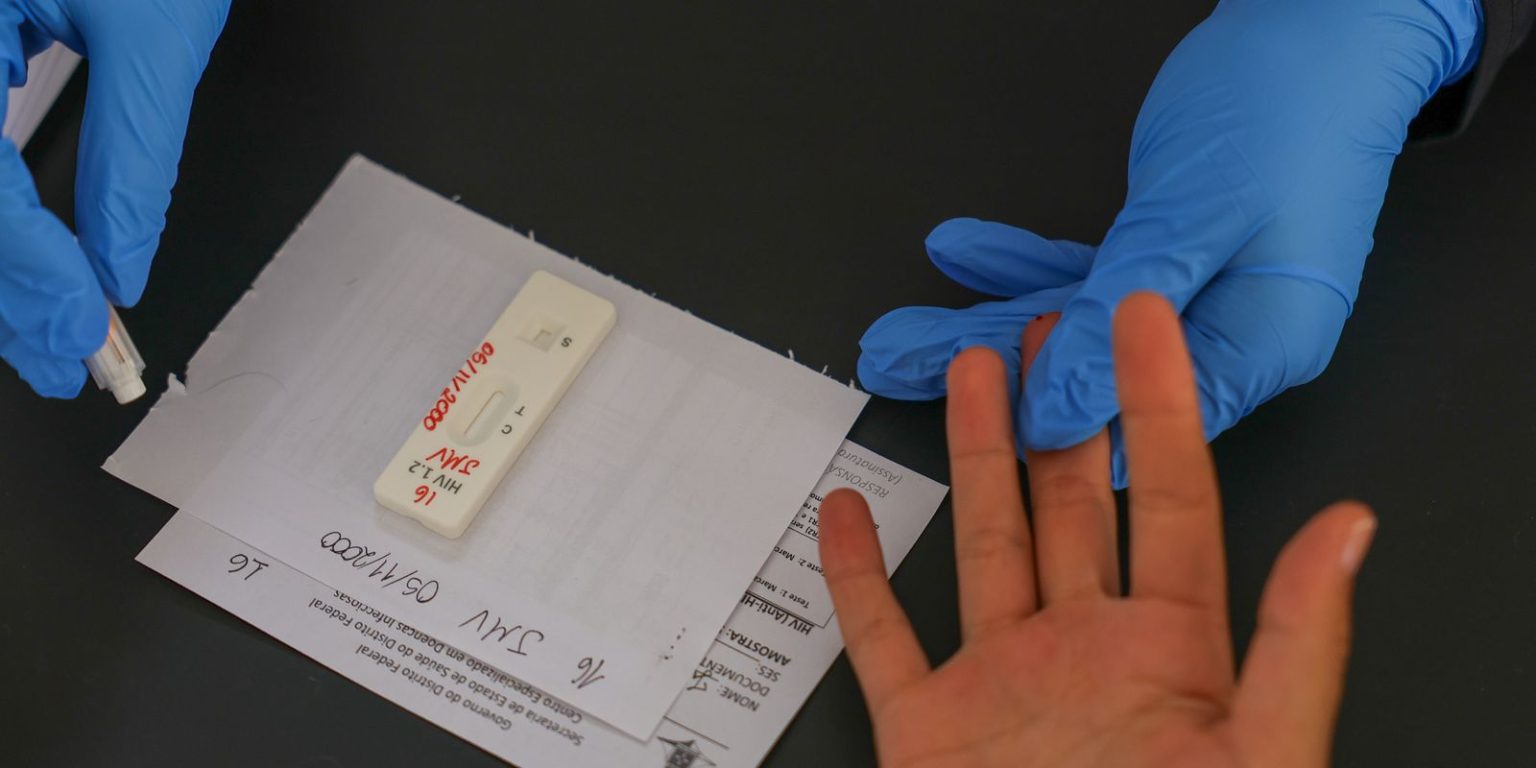 Brasil busca acordo para prep de longa duração contra hiv no sus