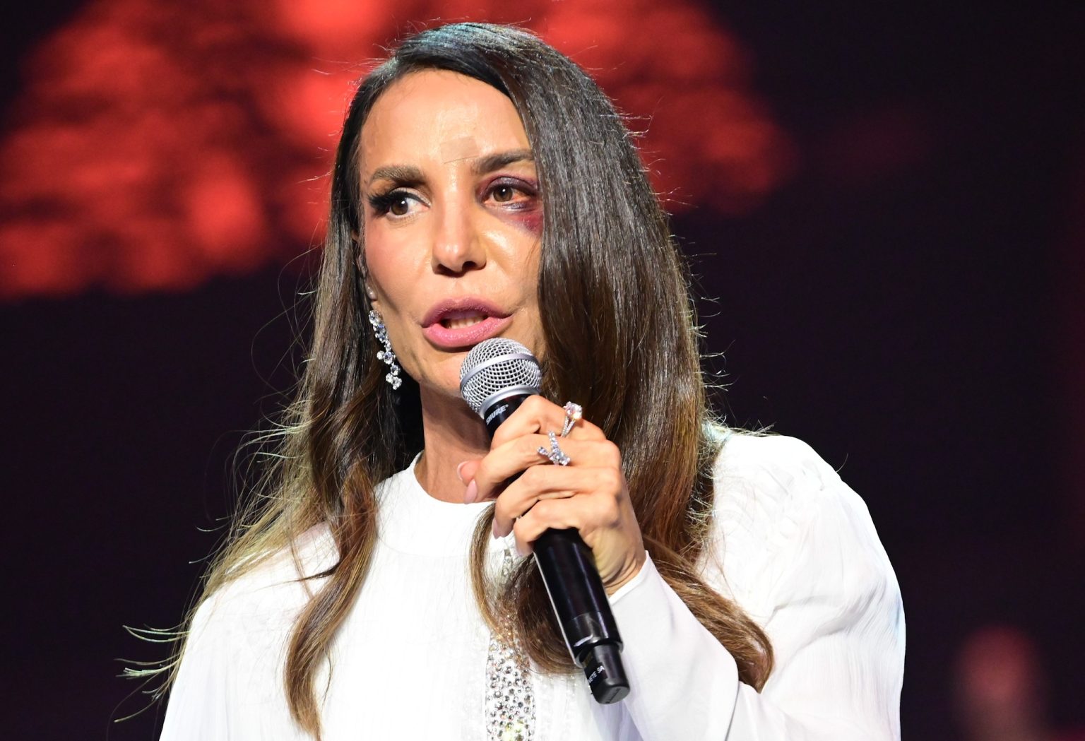 Ivete Sangalo anuncia cirurgia após mal-estar e desabafo em show