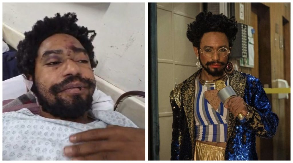 Ator de Drag Queen é Vítima de Ataque Homofóbico em Adega no Centro de SP