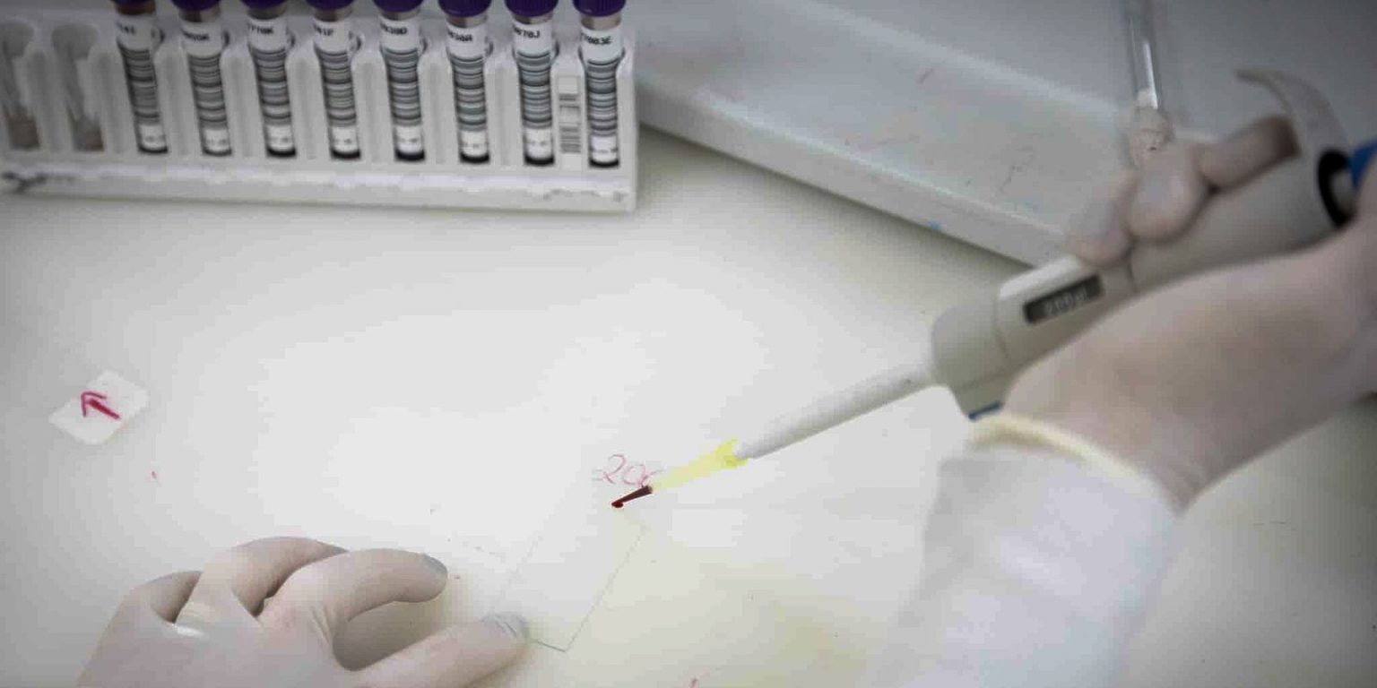 Paciente infectado com meningite meningocócica em SP: suspeita de ebola ainda em investigação