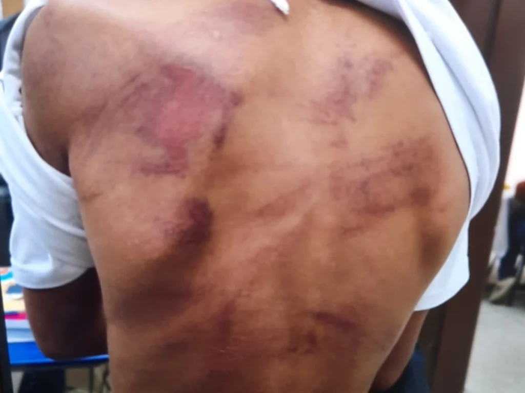 Pai é detido por suspeita de violência contra filho de 9 anos em Piracicaba