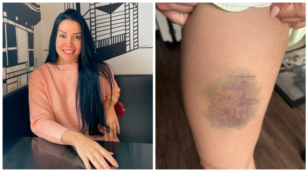 Nutricionista cearense sobrevive a tentativa de estupro em SP após aula de defesa pessoal com simulação do crime