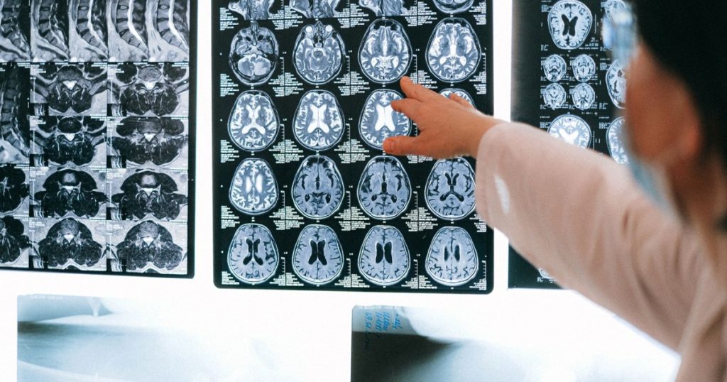 Fatos Surpreendentes sobre o Cérebro: Descubra Curiosidades Fascinantes fatos surpreendentes sobre o cérebro