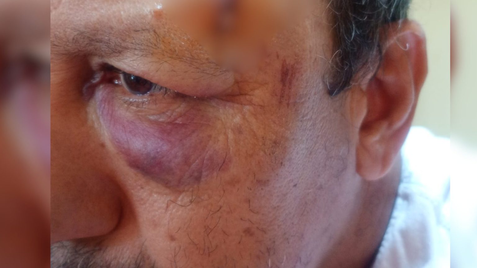 Tropeiro sobrevive após levar coice de boi na cabeça durante rodeio em Santa Fé do Sul