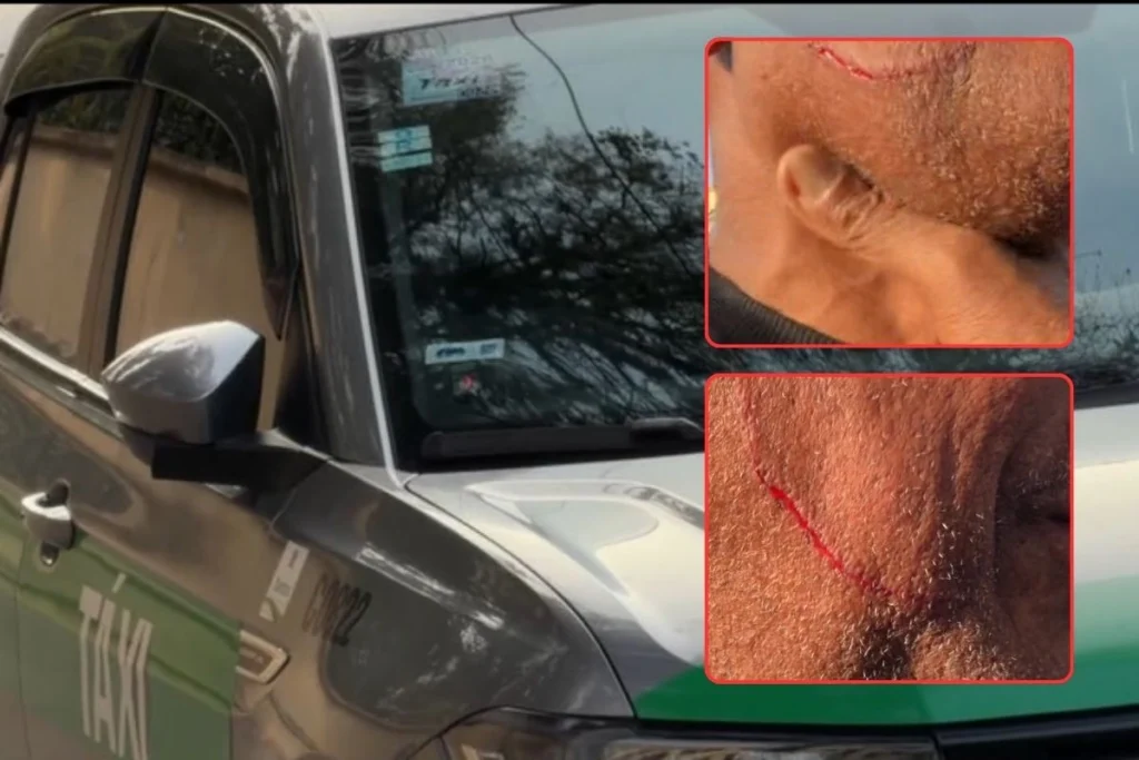 Taxista é atacado com canivete por passageiro durante corrida em Santos, SP