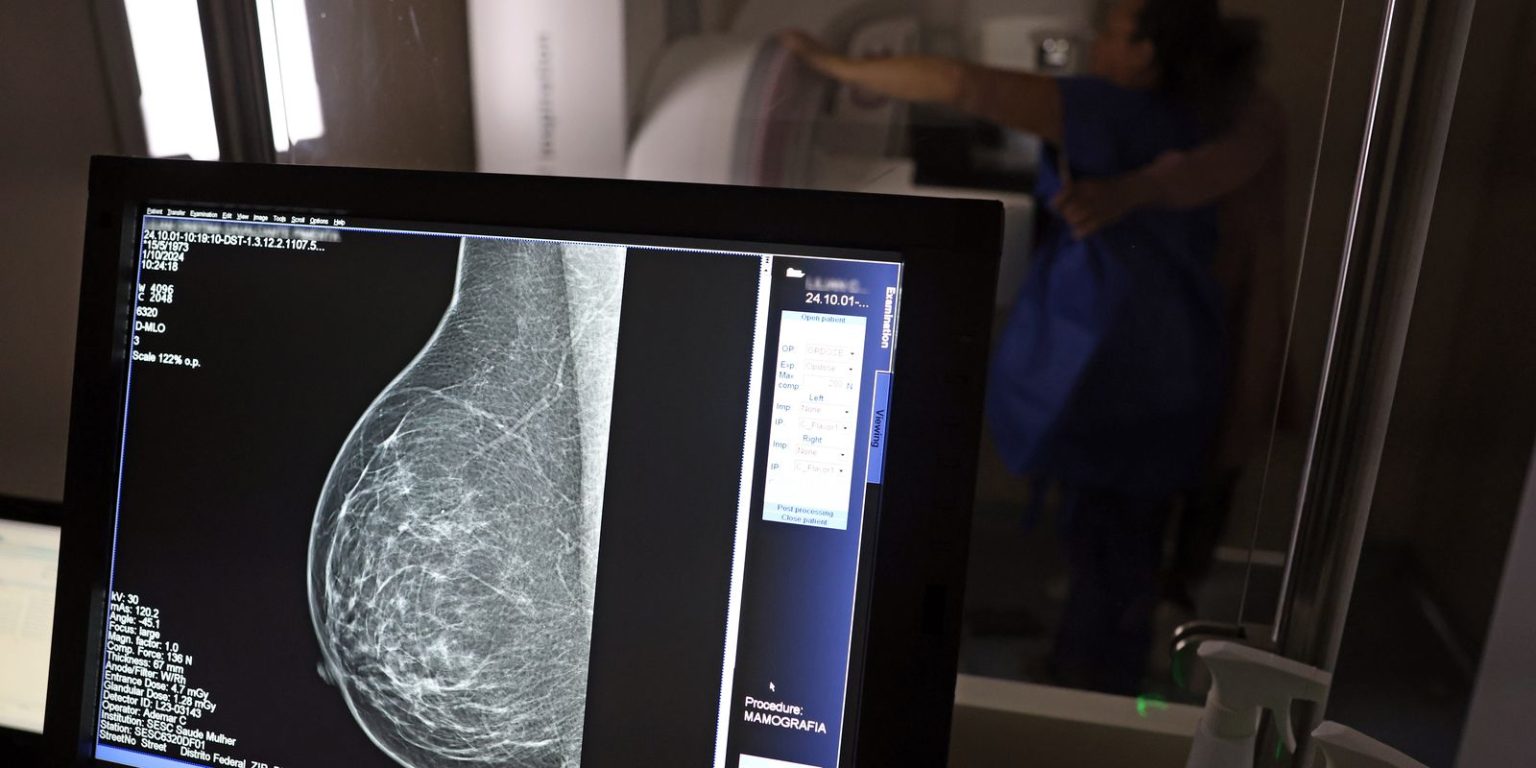 Planos de Saúde Devem Cobrir Mamografia Digital para Todas as Idades