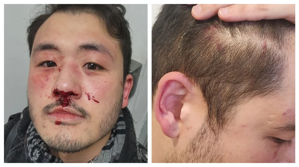 Professor de inglês é agredido em estação do metrô de SP em possível ataque homofóbico